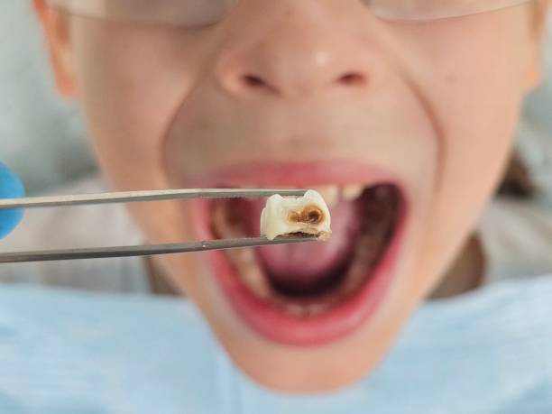 Best Urgent Tooth Repair  in Midway, KY